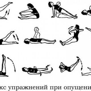 Опущение матки